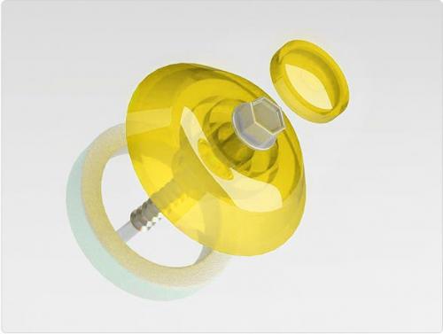 Каркас для поликарбоната из металла для стен. Точечное соединение – крепеж