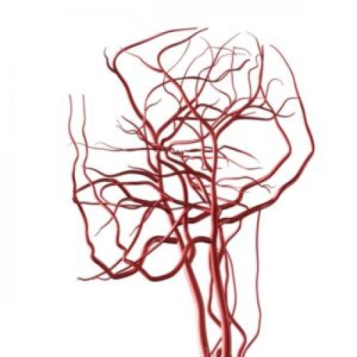 Дуплекс в медицине. (УЗДС) Что такое дуплексное сканирование и когда его делают?