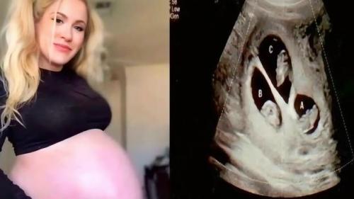 Врачи сделали узи - и были в шоке.  